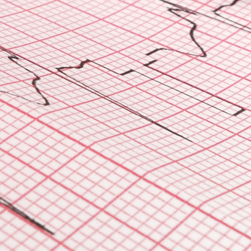 ecg paper type