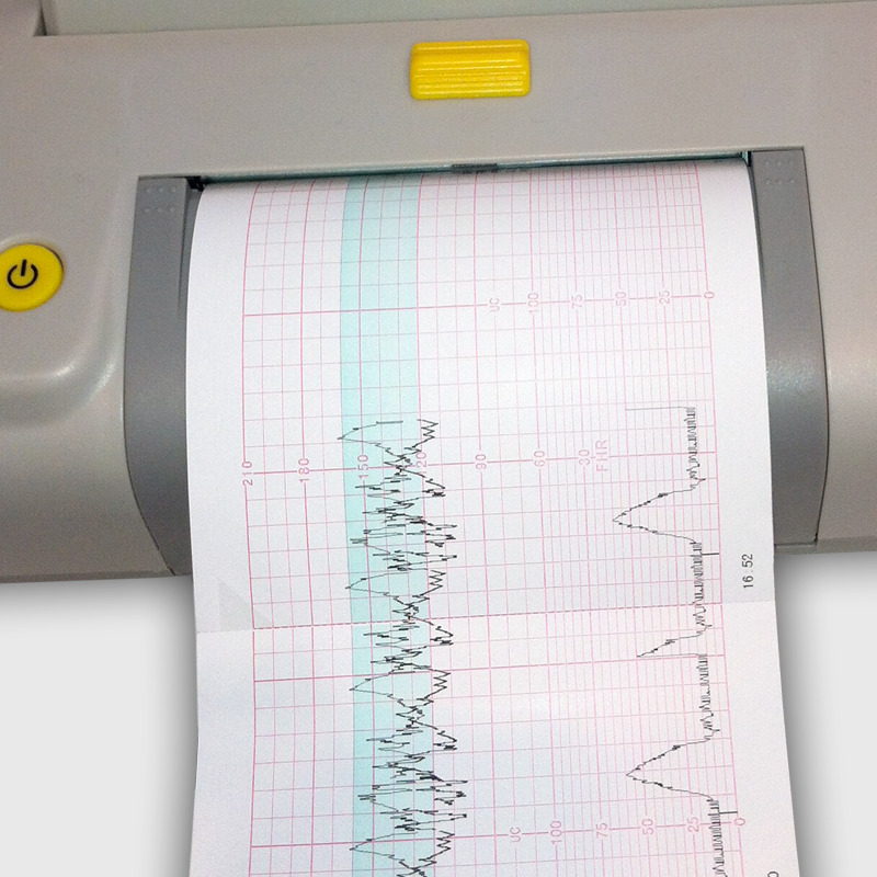 Cardiotocography Recording Paper