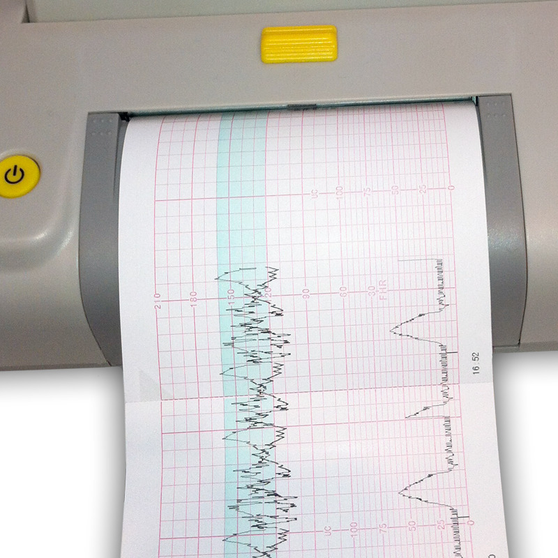 Cardiotocography Recording Paper